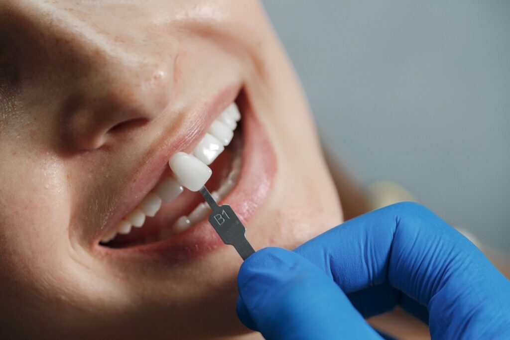 Dental Implants Canning Vale | Restorative Implant Dentistry