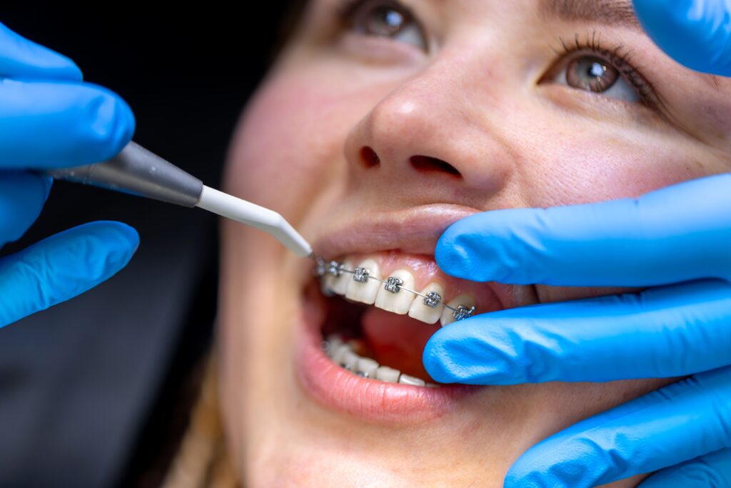 Emergency Dentist Canning Vale | Urgent Dental Care