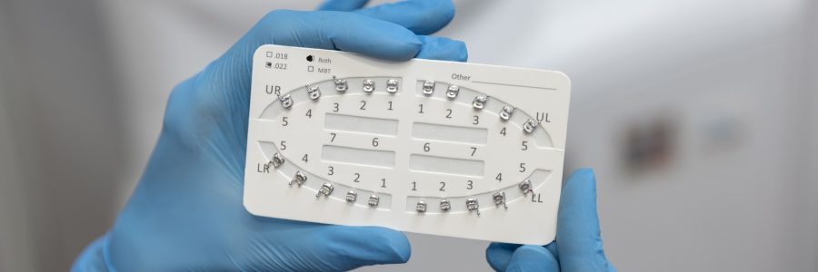 Dental Braces Near Willetton | Orthodontic Assessment