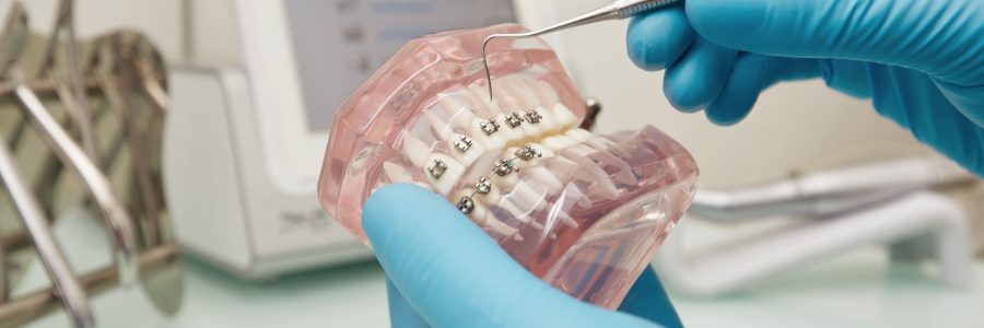 Dental Braces in Canning Vale | Orthodontic Consultation